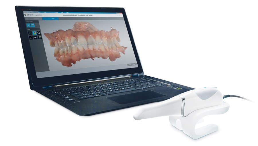 Scanner intra-oral Carestream CS 3600