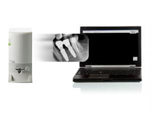 Carestream CS 7200 Optimisation