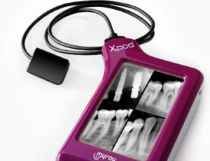 Capteurs RVG Myray XPOD sans fil