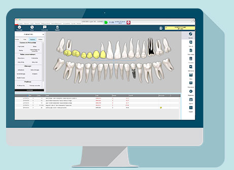 visiodent_ligne_500_plan_de_traitement - Denta3D 