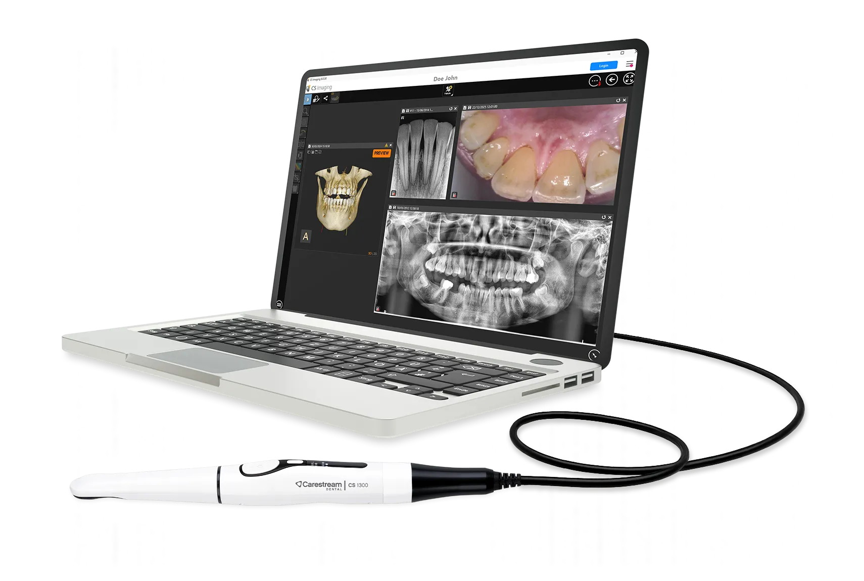 Laptop CS 1300 CS Imaging 2-converti-depuis-png