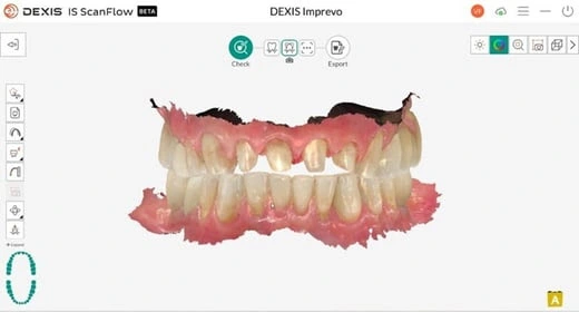 Imprevo (2) WEBP