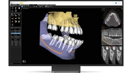 Découvrez les nouvelles fonctionnalités de CS 3D Imaging Prémium CARESTREAM
